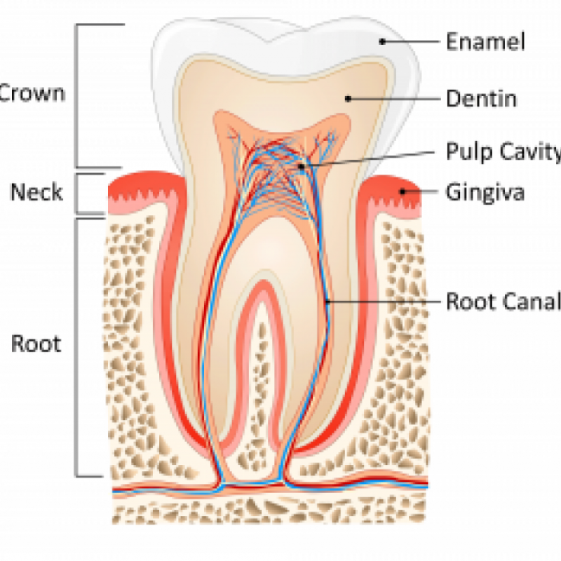 Dental implants